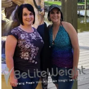 Weight Loss Surgery Before And After Alicia B - 1 Year Update*